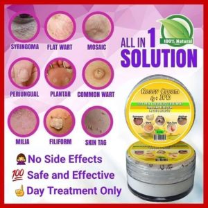 Kasoy Cream Wart Remover Skin Gel