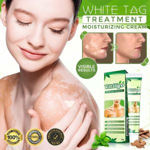 Vitiligo Therapeutic Cream